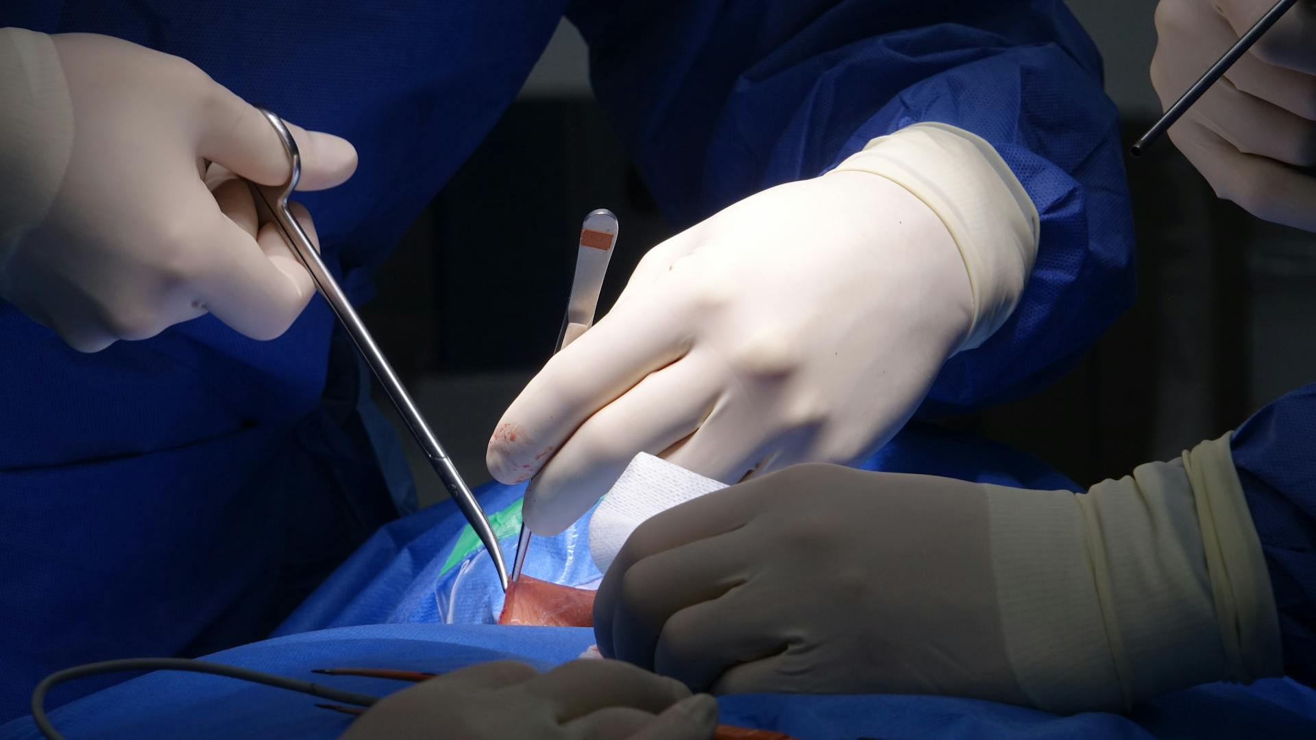 Reconstructive Surgery